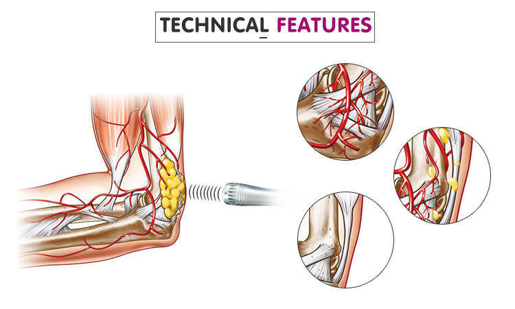 冲击波理疗仪电磁点阵冲击波疼痛理疗仪按摩枪筋膜枪