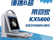 便携黑白B超 厂家直销【凯信B超KX5600】