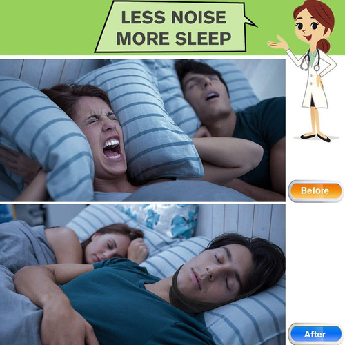 Anti-snoring chin strap adjustable snoring strap anti-mouth breathing chin protection anti-snoring strap sleep aid