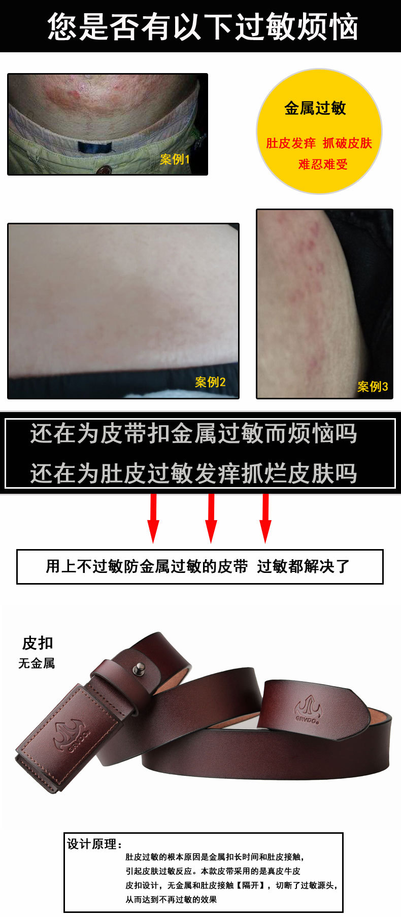 防过敏皮扣P001_05.jpg
