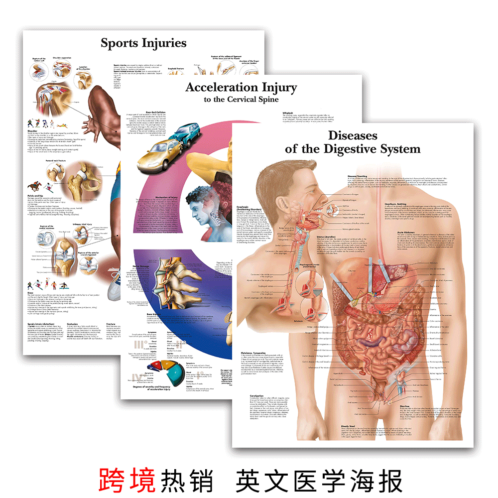 亚马逊跨境批发教育医学海报 人体解剖疾病图表医院书房三联画