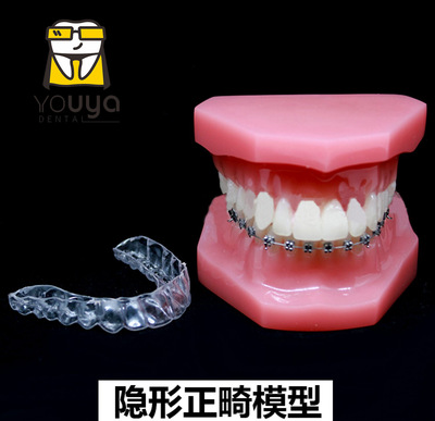 隱形正畸模型 牙齒模型牙齒矯正牙科模型 口腔教學模型 牙模型