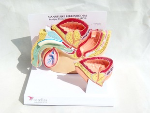 Male Bladder Prostate Model Normal Hyperplasia Prostate Examination Detachable Prostate Model