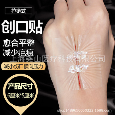 Put up Zip Bandage Wound suture Tension reducer suture Wound Pull together Band Aid 2