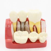 ����4���Nֲ�wģ�� ��ǻ�̌W�þ�ģ�� �Nֲ�ֽ��t����ͨģ��