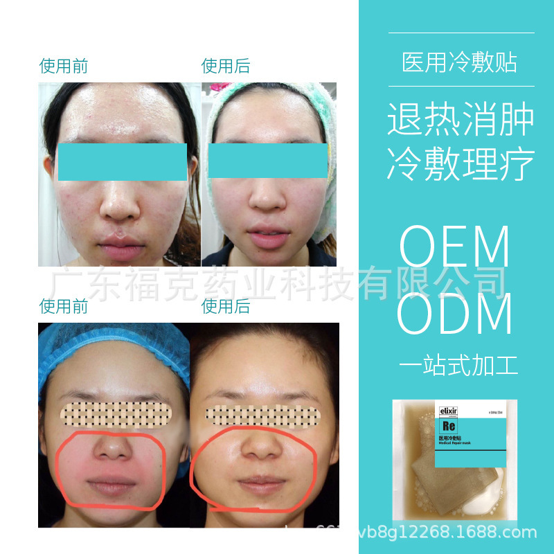 福克药业修复抗肿胀抗修复面膜激素脸敏感肌过敏修复舒缓镇静OEM