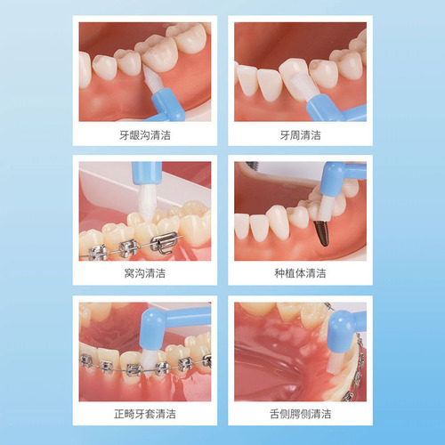 Manufacturer Direct Sale Orthodontic Toothbrush Special Single-Tip Braces Toothbrush Soft Bristles Cleaning Wisdom Teeth Gum Gap Brush