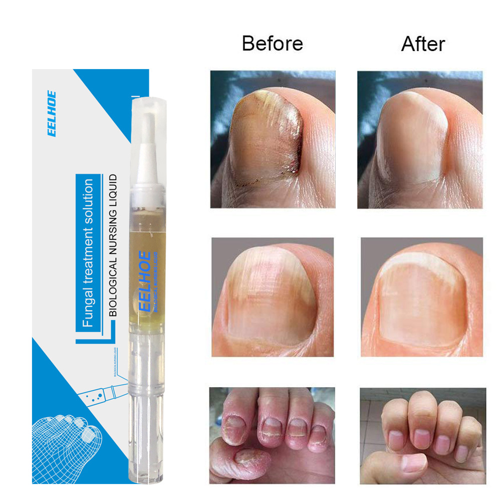 EELHOE Grey Nail Liquid Application