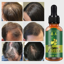 羳ol͝Bl^lIBҺlHair growth oil