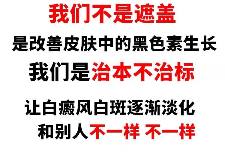 白癜风光疗仪银屑病治疗仪uvb311白斑紫外线治疗灯仪器中药理疗