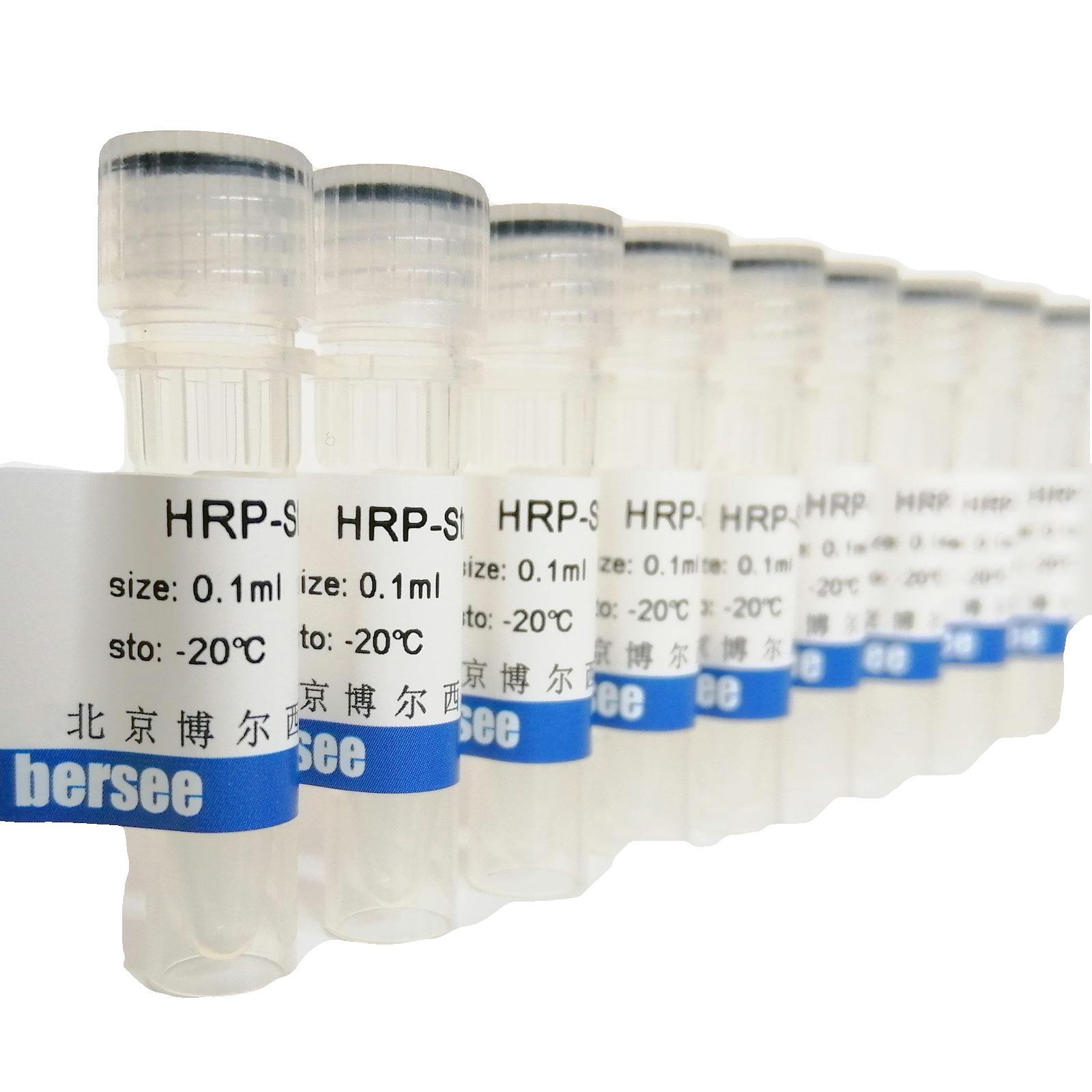 兔抗人Ig-FITC  荧光素标记兔抗人IgG、A、M 多克隆抗体