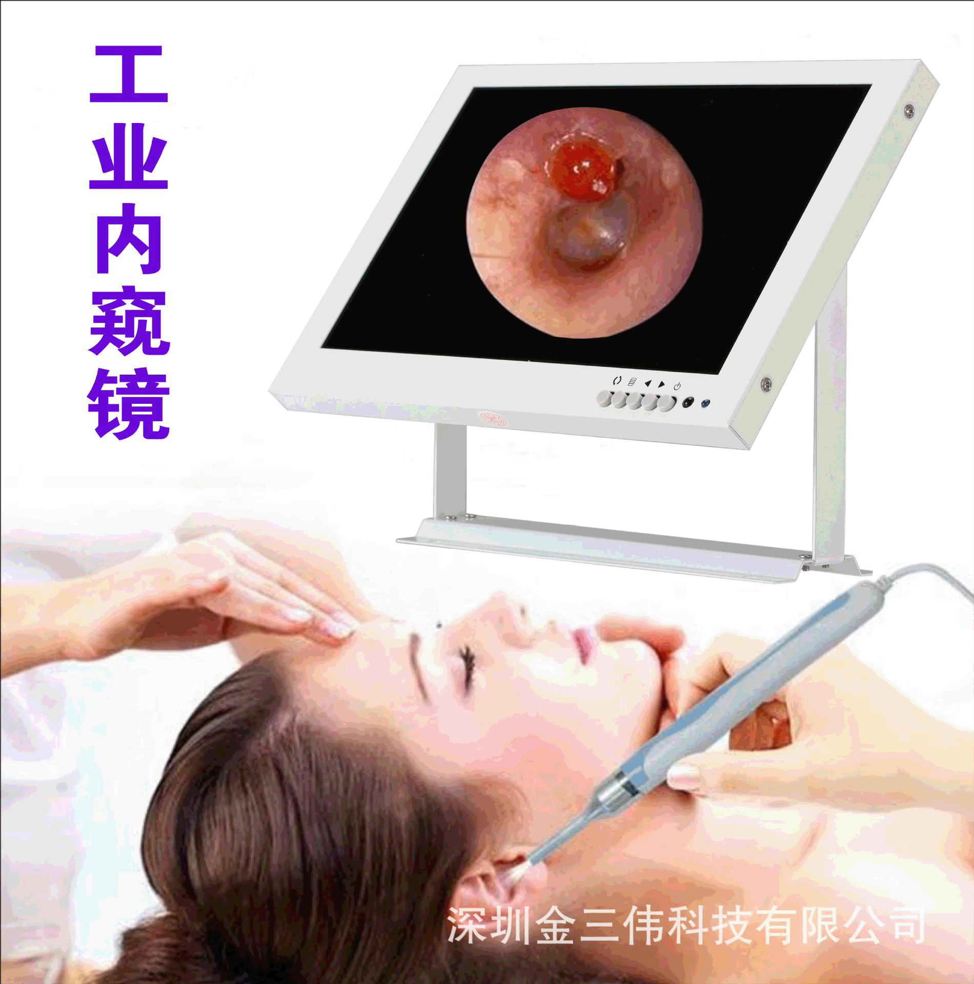 厂家直销10.1寸液晶显示器白色高清医疗设备可定格拍照存储监视器|ru