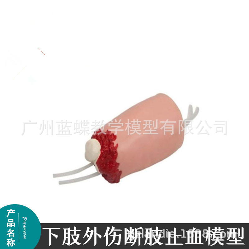 外伤断肢止血1