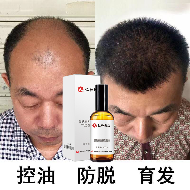 Renhe Pharmaceutical Anti off Happen Sterile liquid Issuing agent Long hair changeable Nutrient solution Jingha men and women