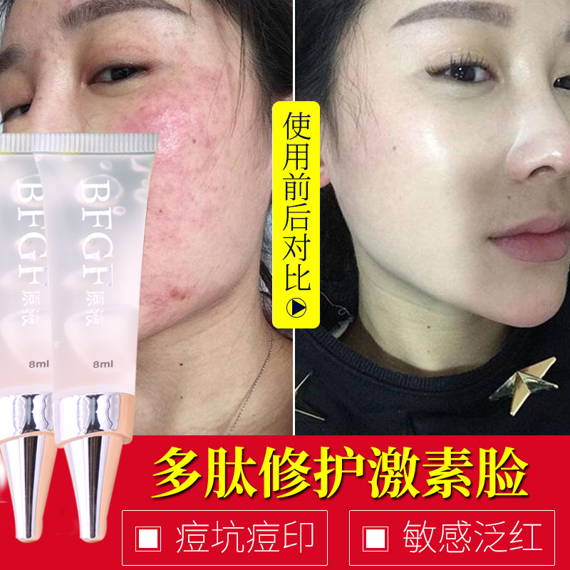 BFGF活肌修护原液8ML 雅帝软管啫喱精华 解决各种受损肌肤OEM批发|ru