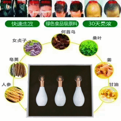 热销涂抹式养发液护发素防脱发掉发强健发根毛囊美容院头发增长液|ru