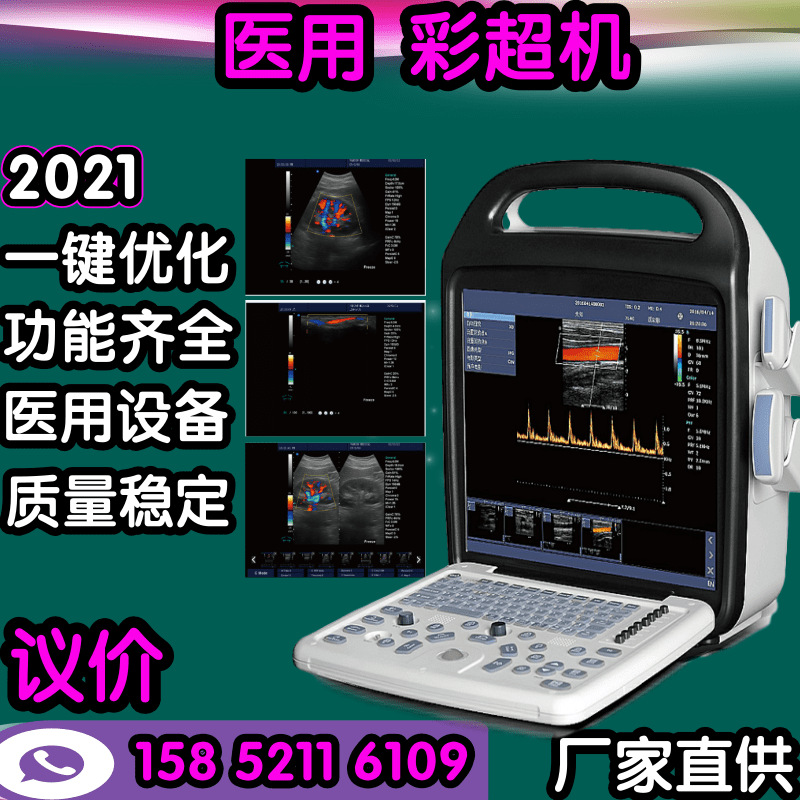 Color Doppler ultrasound machine portable Color Doppler ultrasound machine direct deal Color ultrasound machine Doppler Ultrasound Diagnostic Price