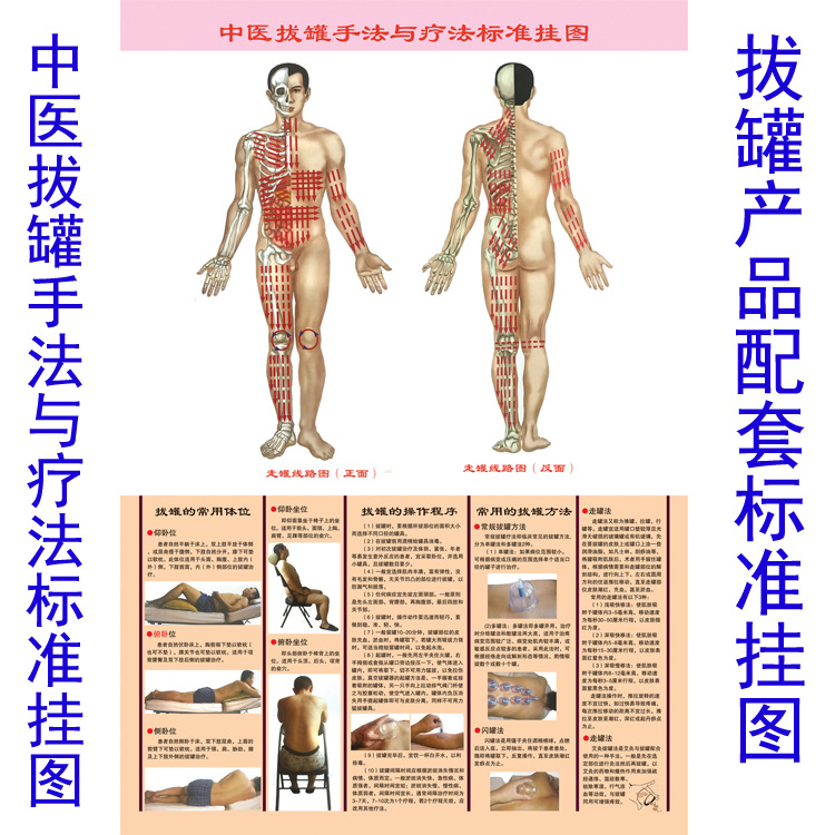 拔罐挂图中医拔罐手法标准挂图刮痧拔罐经络穴位标准挂图|ms