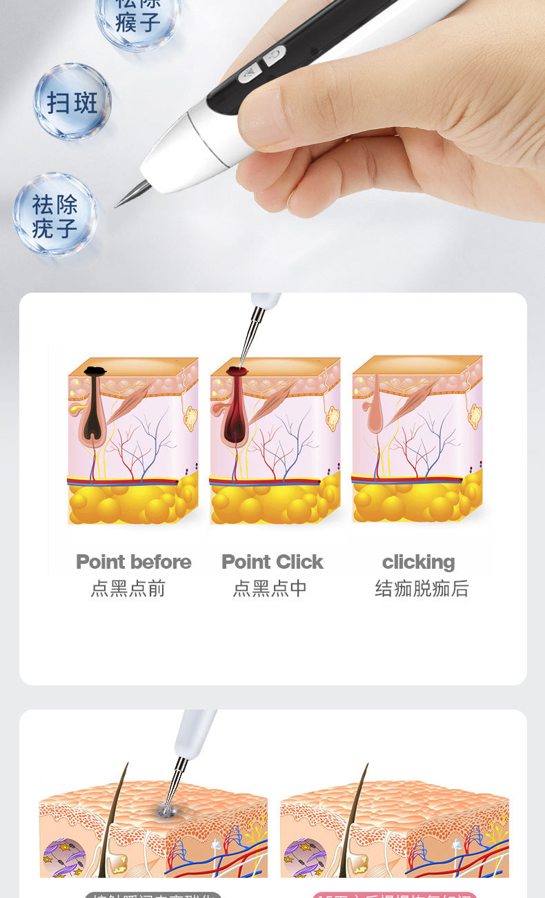 853祛斑笔详情页_07