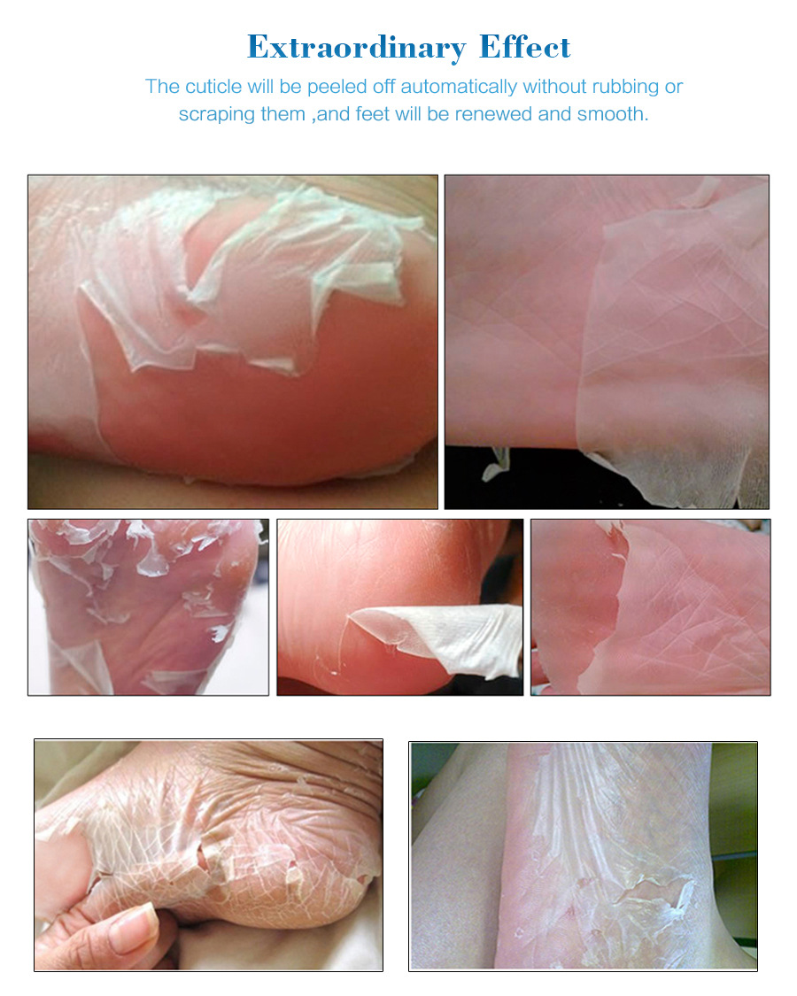 EFERO Foot Mask Treatment