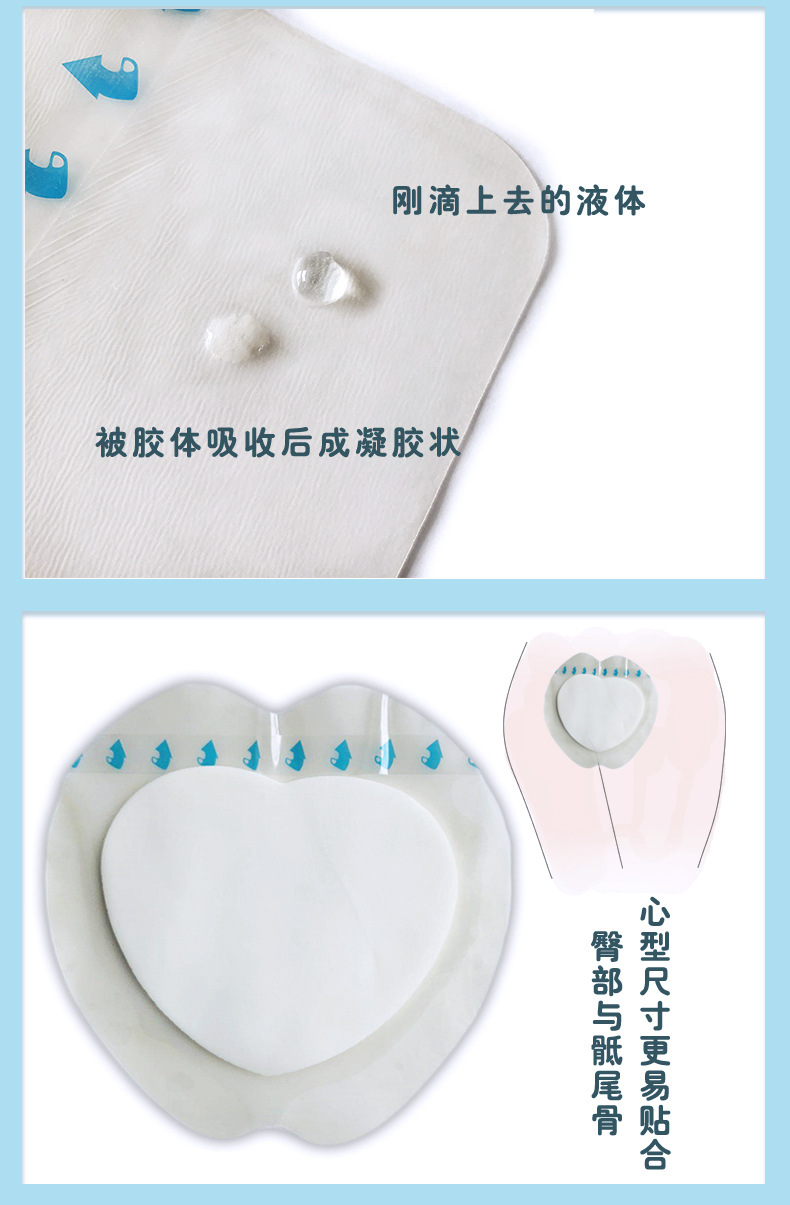 水胶体褥疮贴
