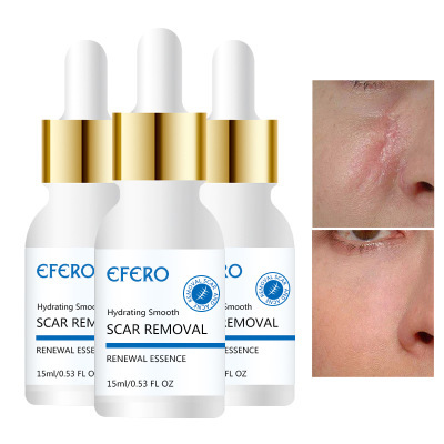 Acne Scar Repair Essence Image 1