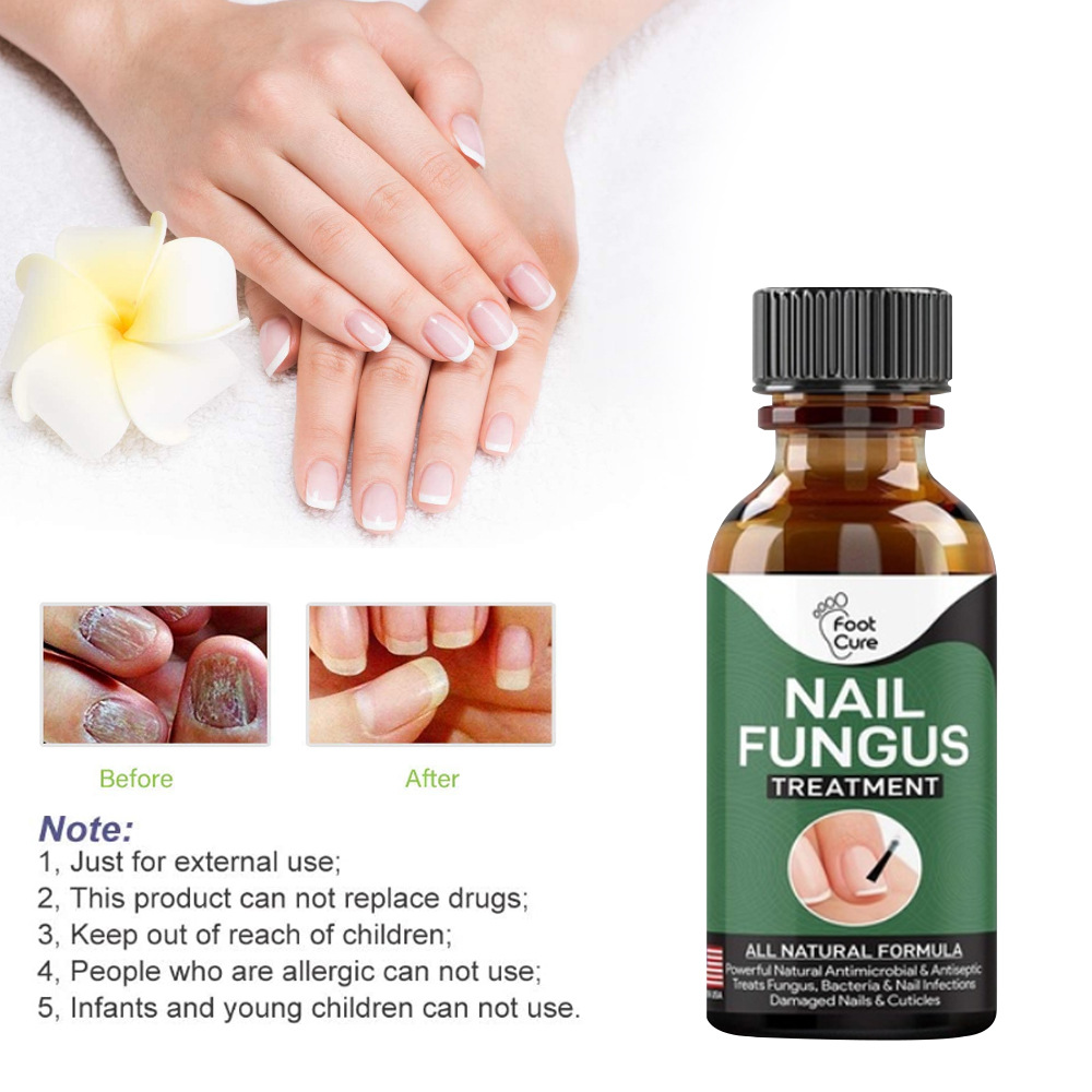 Nail Repair Liquid Hand and Foot Onychom...