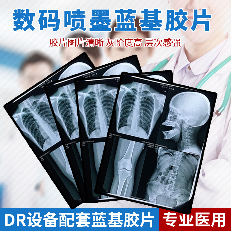 医用蓝基反射科喷墨高清打印胶片DRCT核磁骨科蓝色喷墨打印机胶片