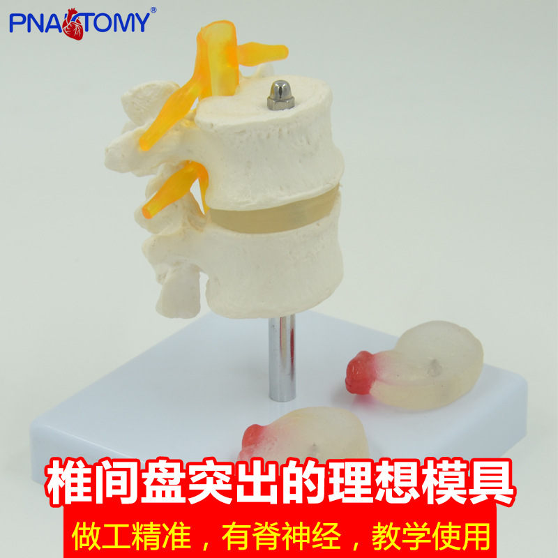 human body Lumbar Model Disc Nerve root Skeleton anatomy Medicine gift teaching Exhibition prop