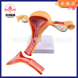 子宫模型女性内生殖qi官 生殖结构妇科模型子宫解剖模型示教模型