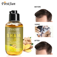 ޹FirstsunϴlˮˬBϴl¶ anti hair loss