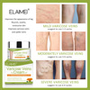 Elaisei varicose vein cream, quiet earthworm legs, blue tendons, relieve pain, red blood wire repair red flower cream spot