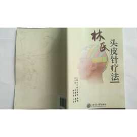 头皮针图片 海量高清头皮针图片大全 阿里巴巴