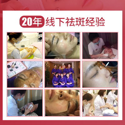 爆款祛斑霜正品美白去斑雀斑淡斑点斑水神器淡化色斑黄褐斑官网女