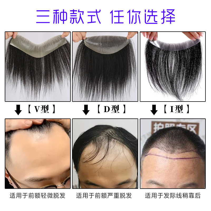 Wig men's hairline patch men's forehead patch real human hair biological scalp fake bangs in stock