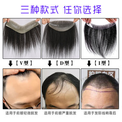 Hairpiece for men, frontal hairline filler for men, frontal hairpiece for men, real hair bio-skin lace front wig