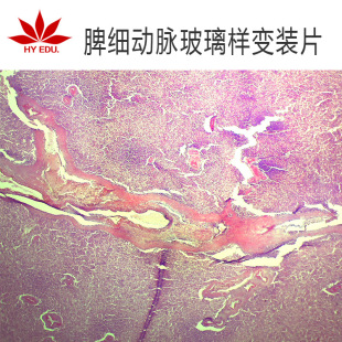 Ƣ�����}������׃�bƬ ����������Ƭ �߽̘�׼�@΢�R�^�쌍��о�