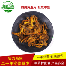 �a��؛Դ��ș�����l�S�B �Ĵ��S�BƬ�uצ�B ��֦�B��ĥ������֮��