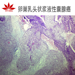 �t�~�̃x�����M���ѳ����^��{Һ�����ٰ��@΢�R�^��߽�������Ƭ