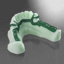 iFun牙科铸造光敏树脂高精度高硬度牙模牙科支架假牙医学牙模生产