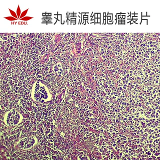 病理组织睾丸精源细胞瘤装片显微镜配件生物切片教学展示单片可售