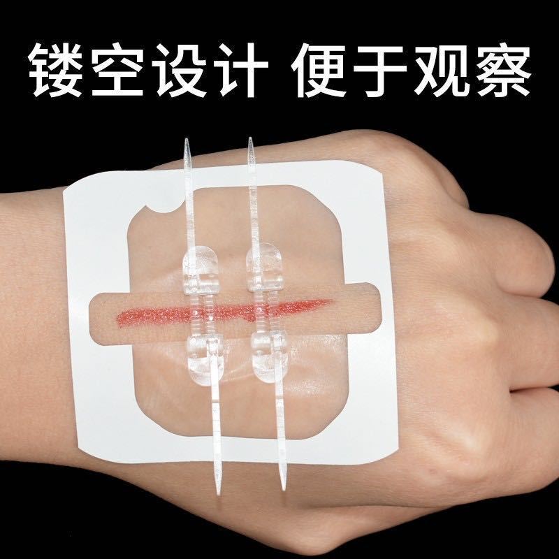 弾性包帯縫合不要ジッパー式創傷保護テープ皮膚用創傷保護テープ縫合不要貼り付け|undefined