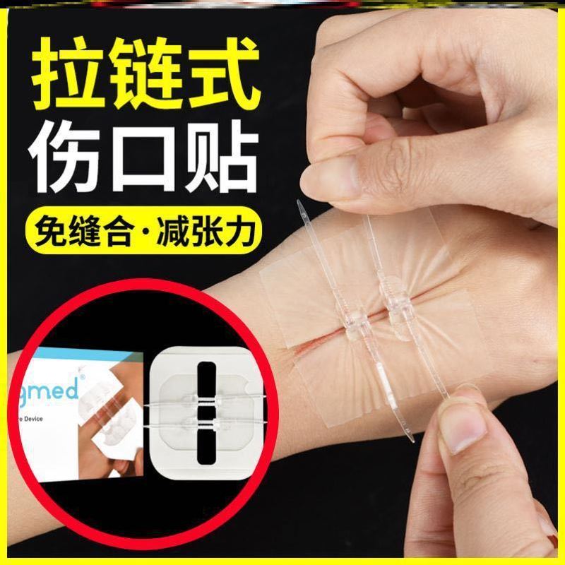 Elastic Bandage Adhesive Patch Zipper-Type Band-Aid Wound Tape Skin Band-Aid No-Sew Adhesive Patch