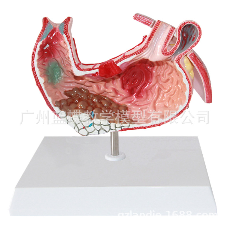 θ����ģ�� ����θģ�� θ��������ʾģ�� ����θģ�� ����θģ��