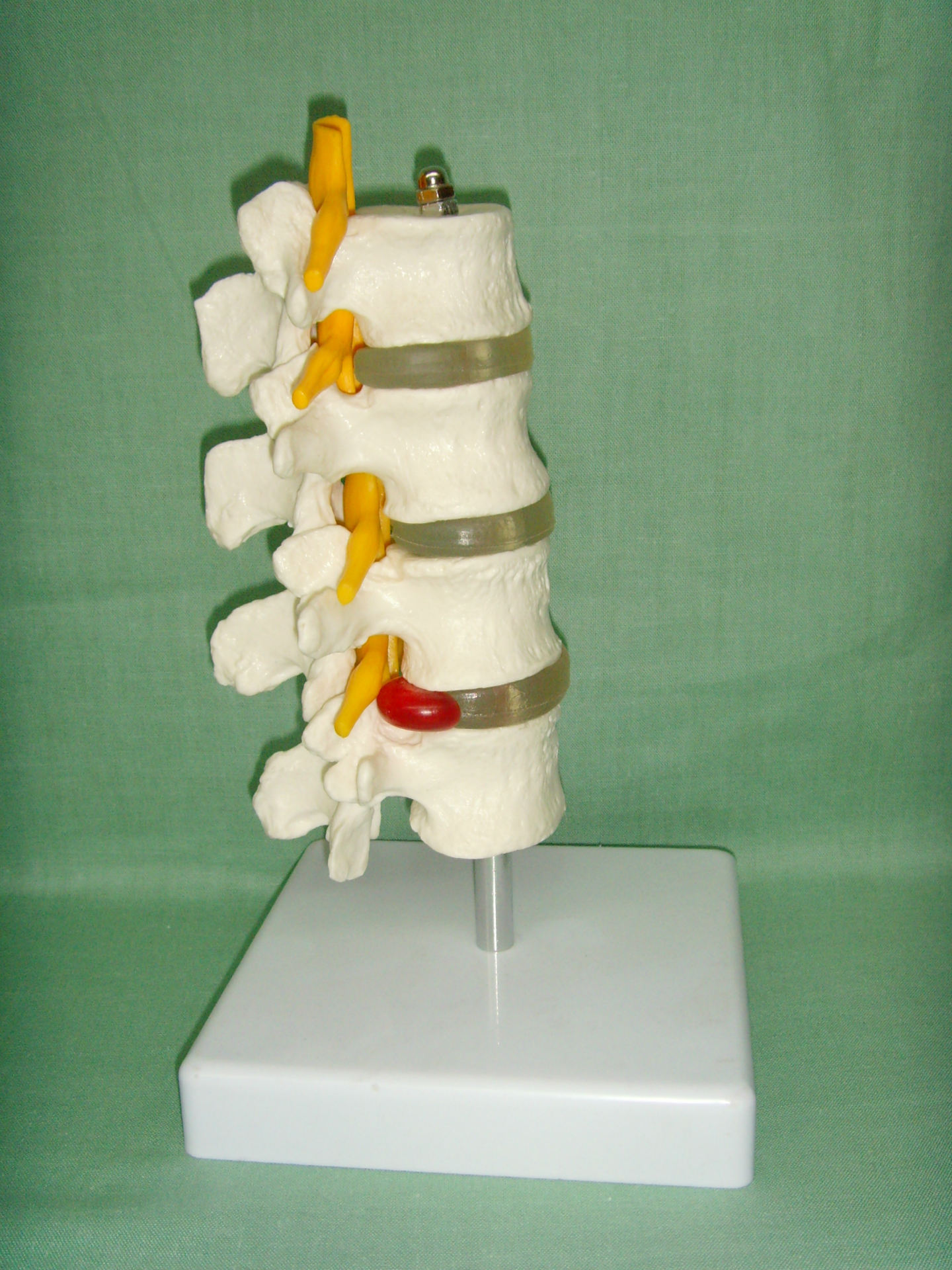 ��׵ģ�� �Ľ���׵ ����ģ�� ��׵��׵���̴��񾭸�ģ��