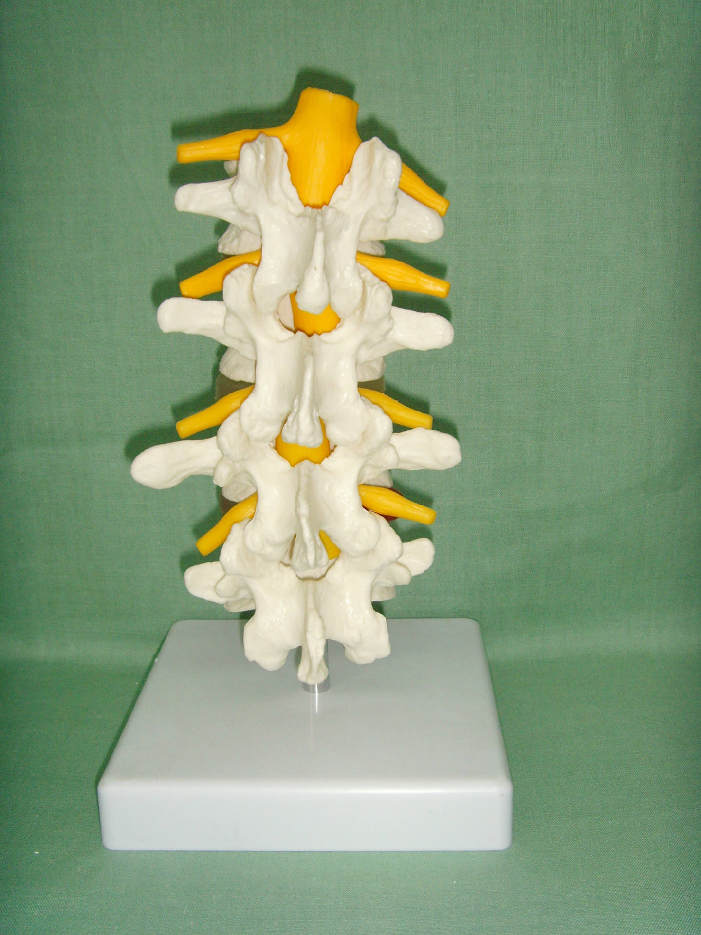 ��׵ģ�� �Ľ���׵ ����ģ�� ��׵��׵���̴��񾭸�ģ��