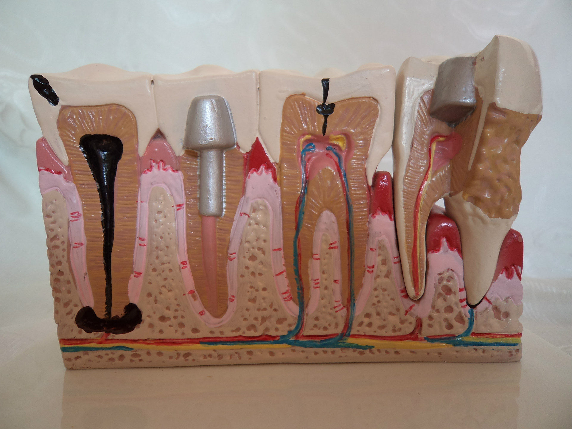 ����ĥ����������ģ�� �Ŵ� �ɲ� ҽѧ��ѧģ�� ����ֱ��