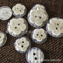�S�Ҙ�֬�y��÷���~���ֹ�diy���˯���r��ë�´��������b���