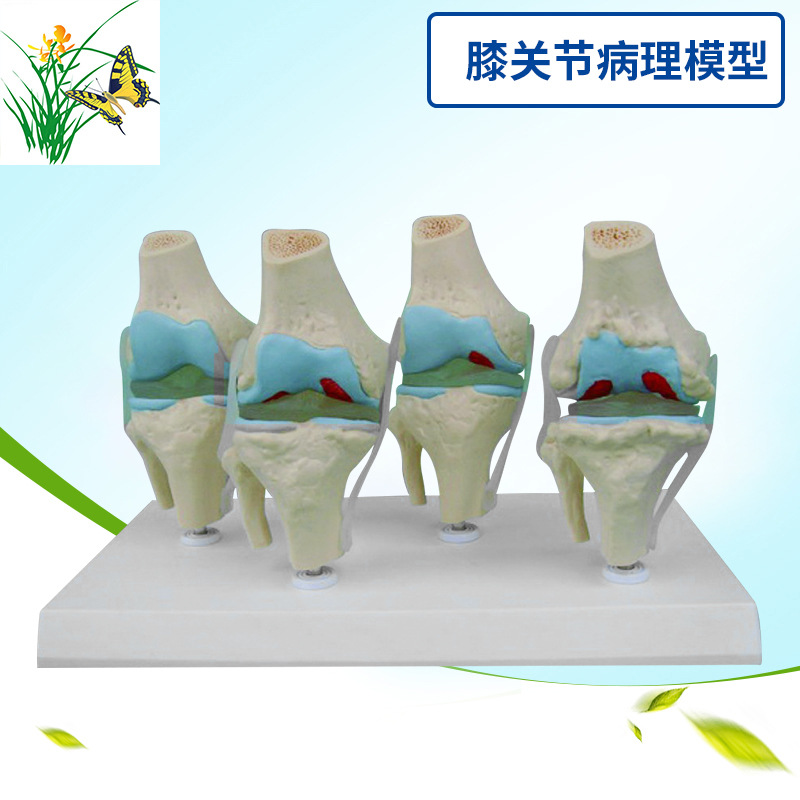 ϥ�ؽ�-����ģ�� �ؽڹ���-��̬չʾ����ϥ�ؽ�-����ģ�ʹ�˵����