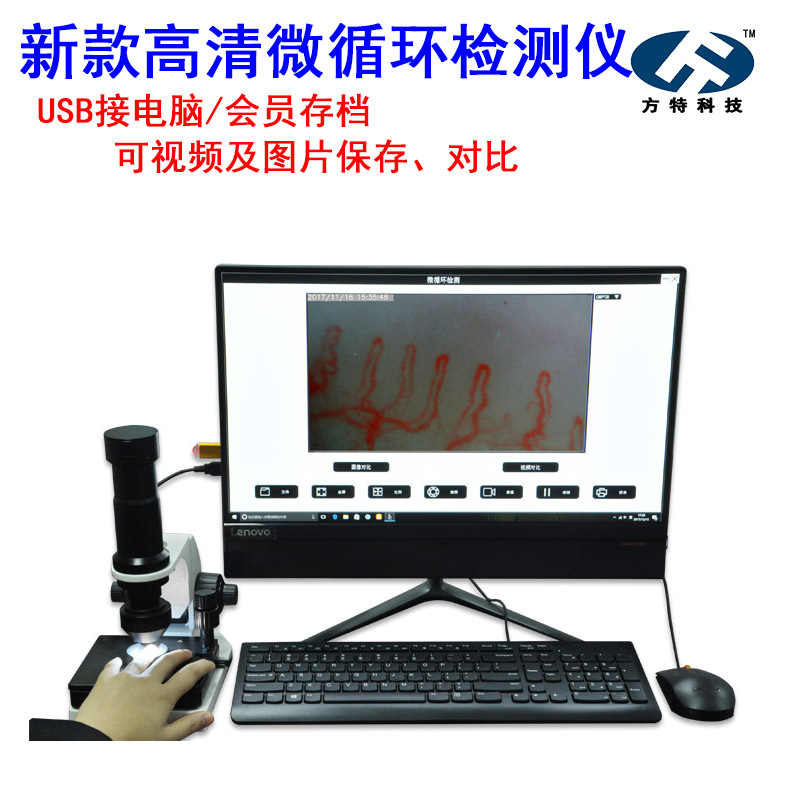 接电脑USBXW880微循环检测仪可拍照保存存档末梢血管观察仪分析仪